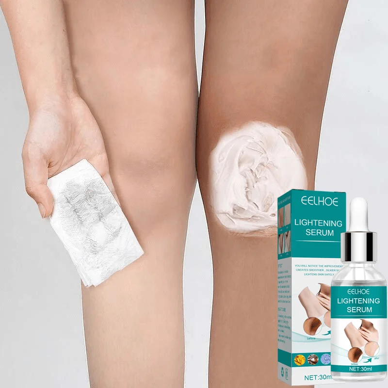 Whitening essence to remove private parts buttocks armpit dark spots and Blemishes skin hip knee thigh inner melanin Beauty and Personal Care Health Care and Fitness 6f6cb72d544962fa333e2e: Option 1